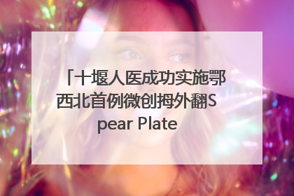 十堰人医成功实施鄂西北首例微创拇外翻Spear Plate髓内板矫形术